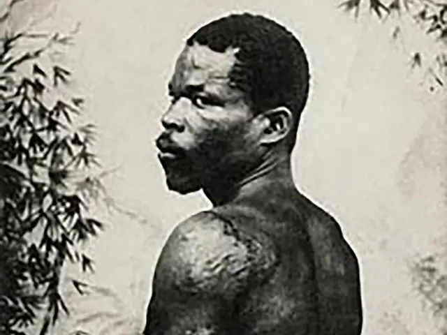 Cyparis Survivant de l'éruption de 1902 Montagne Pelée Saint-Pierre Martinique