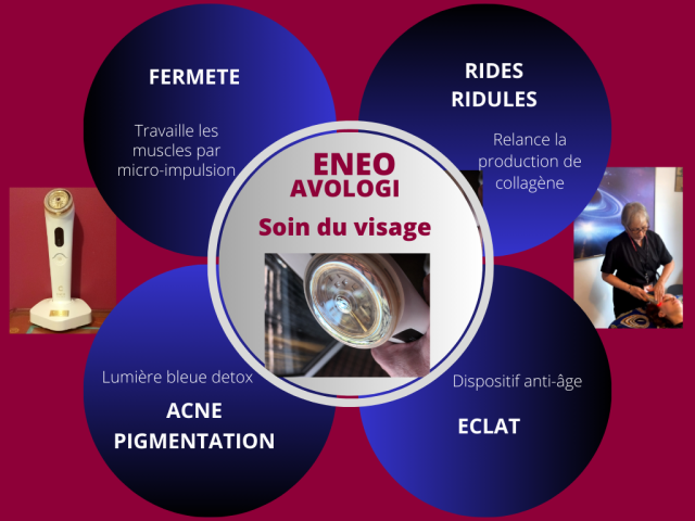 Avologi My